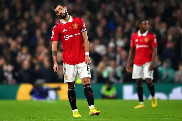 Nyt ei näytä hyvältä - tällainen kuva ManU-tähdestä julkaistiin Nyt ei näytä hyvältä – tällainen kuva ManU-tähdestä julkaistiin