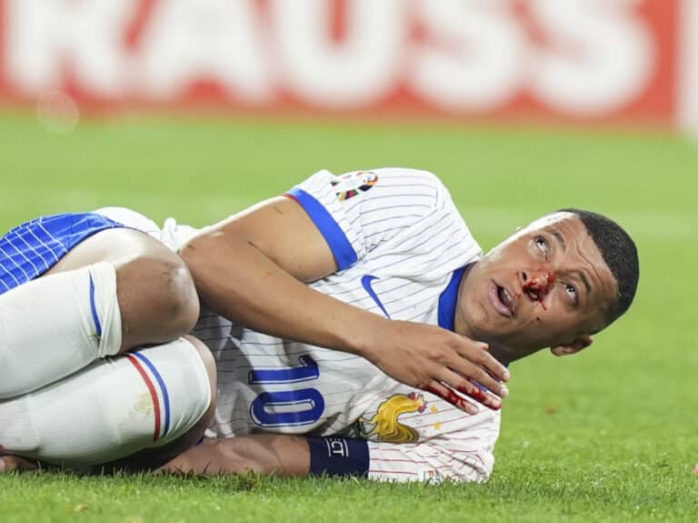 Kylian Mbappe joutuu leikkaukseen