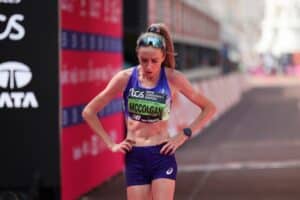 ”Tuntuu kuin jalka olisi räjähtänyt” – brittikaunotar julkaisi paljon puhuvan kuvan onnettomuuden jälkeen