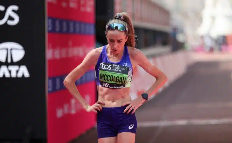 ”Tuntuu kuin jalka olisi räjähtänyt” – brittikaunotar julkaisi paljon puhuvan kuvan onnettomuuden jälkeen